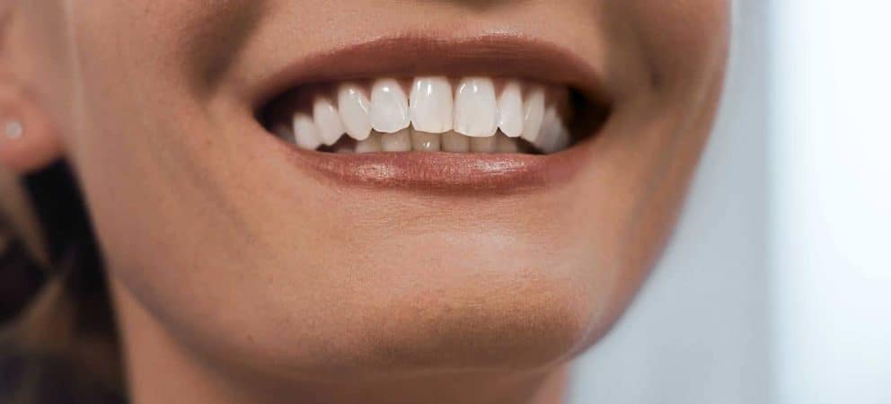 Keramische Veneers.[0.25mm] made in München.