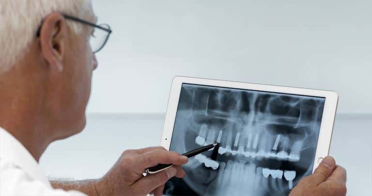 Zahnimplantate – natürliche Stabilität, beständige Ästhetik.