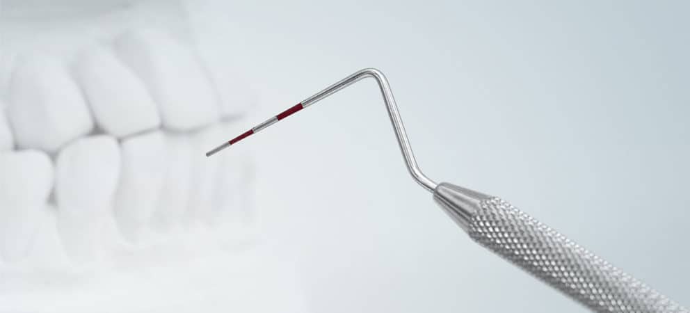 Parodontologie: Entzündungen des Zahnbettes heilen. Parodontologie: Entzündungen des Zahnbettes heilen.