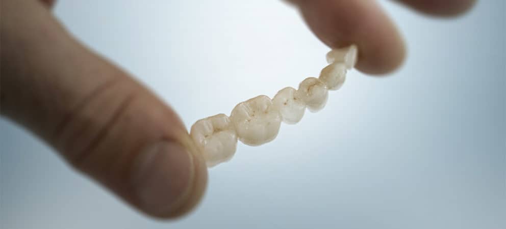 Prothetik: Ästhetischer Zahnersatz mit exzellentem Zahngefühl.