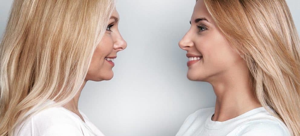 Harmonisierung der Gesichtszüge: Für eine vitale Ausstrahlung.